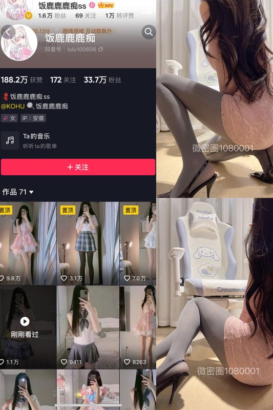 抖音 饭鹿鹿痴 微密圈  NO.020期 【19P2V】最新至：2024.1.14-美图